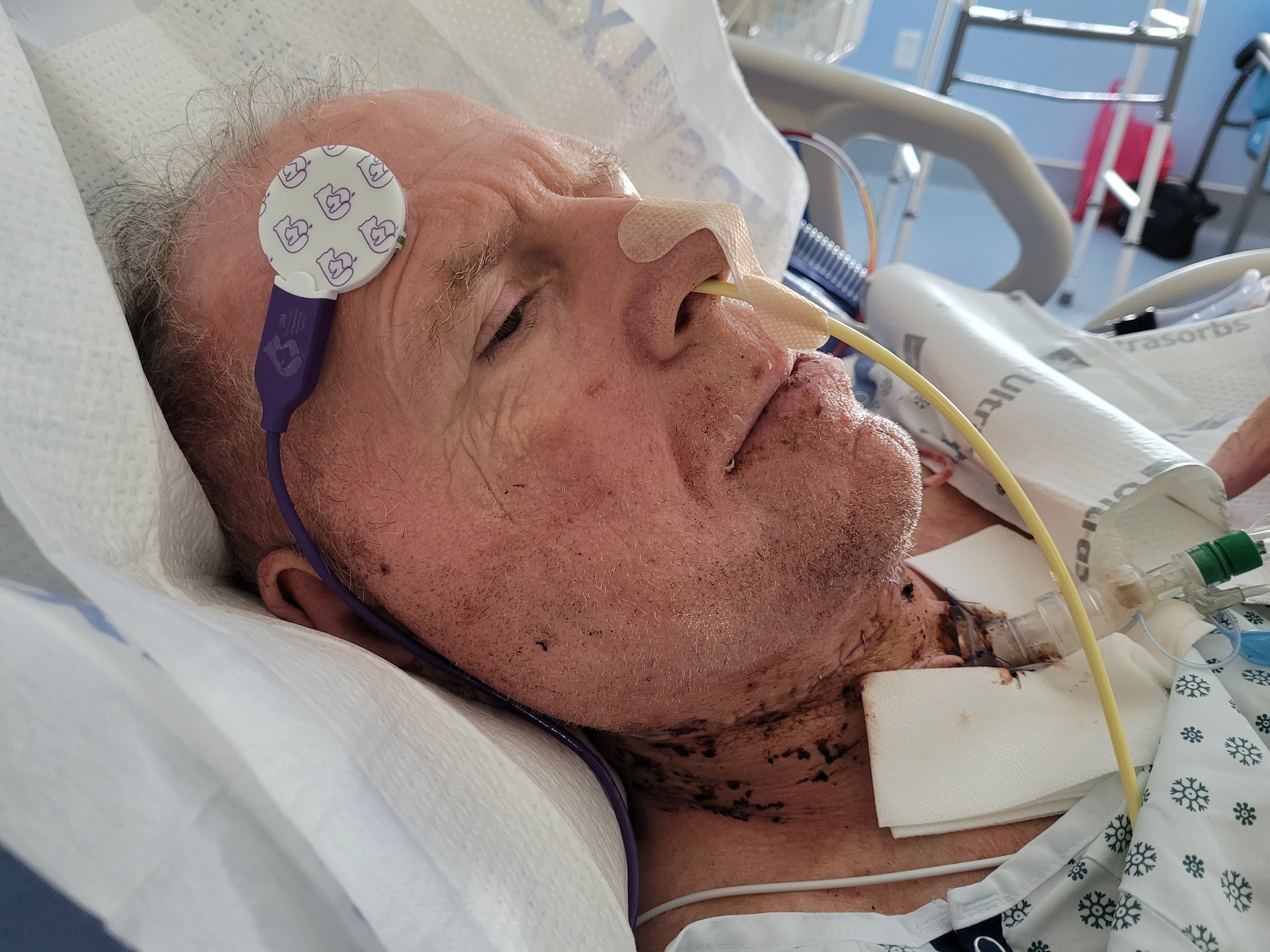 Lingering On The Edge of the Abyss